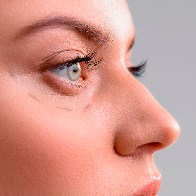 Plástica ocular: saiba mais sobre o procedimento